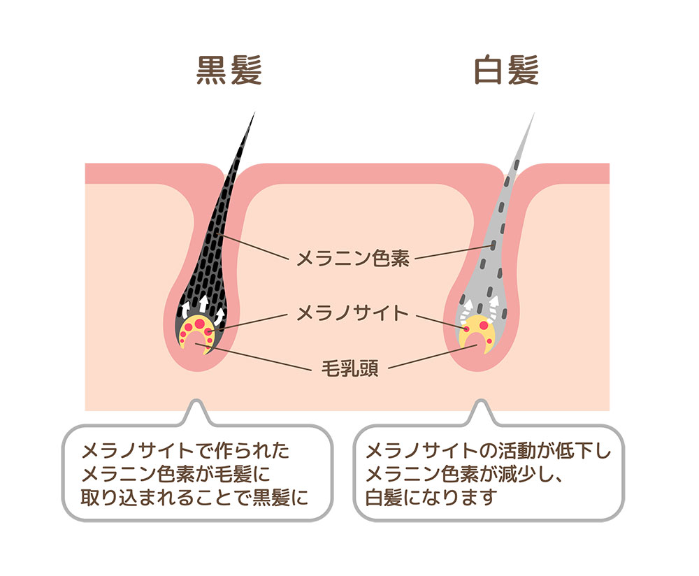 メラチントップは、白髪の抑制・毛髪の成長促進が認められた成分